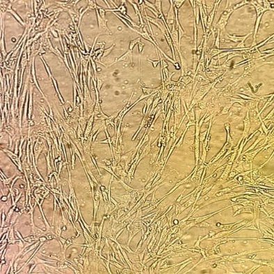 Umbilical cord mesenchymal stem cells