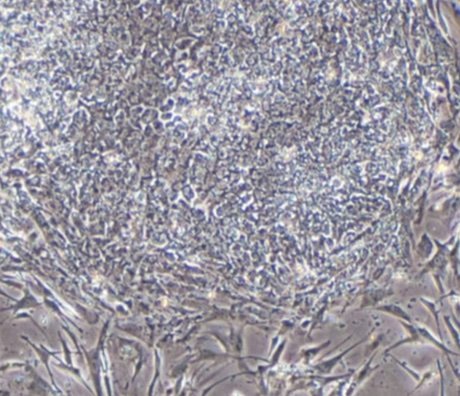 MUSE cells